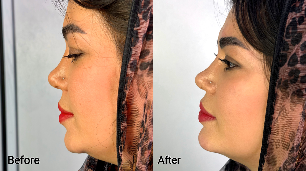 کلینیک زیبایی دکتر ابوالفضل حکیم پور