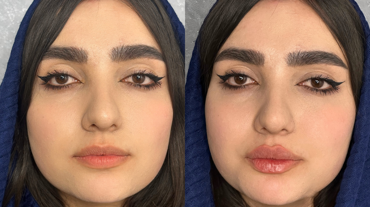 کلینیک زیبایی دکتر ابوالفضل حکیم پور
