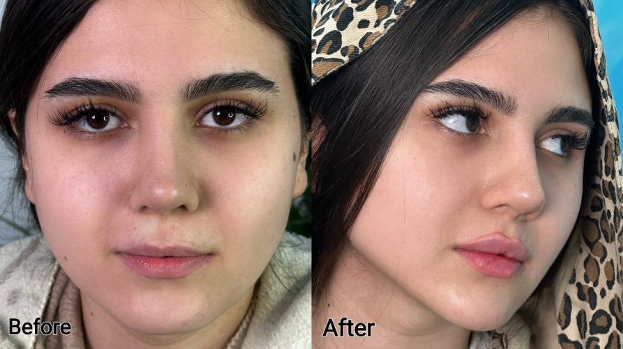 کلینیک زیبایی دکتر ابوالفضل حکیم پور
