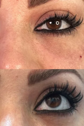 کلینیک زیبایی دکتر ابوالفضل حکیم پور