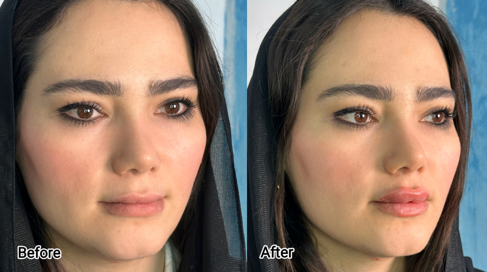 کلینیک زیبایی دکتر ابوالفضل حکیم پور