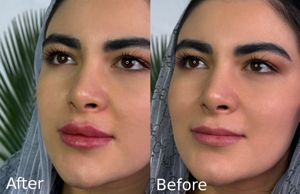 کلینیک زیبایی دکتر ابوالفضل حکیم پور